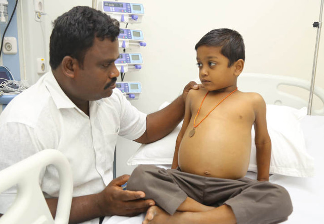 Help 6-Year-old Motherless Child Vetrimaran from Tamilnadu who needs Liver Transplant To Survive. This little boy, who has been suffering for years will lose his life without your support.